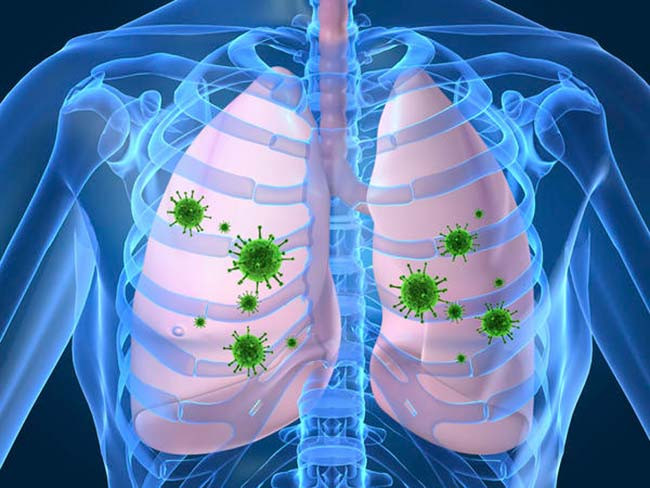 Imagem ilustrativa do curso Doenças Infecciosas e Parasitárias