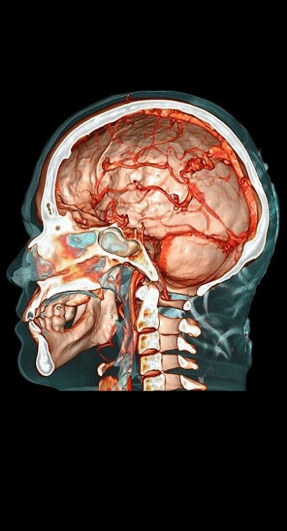 Imagem ilustrativa do curso Neurociências