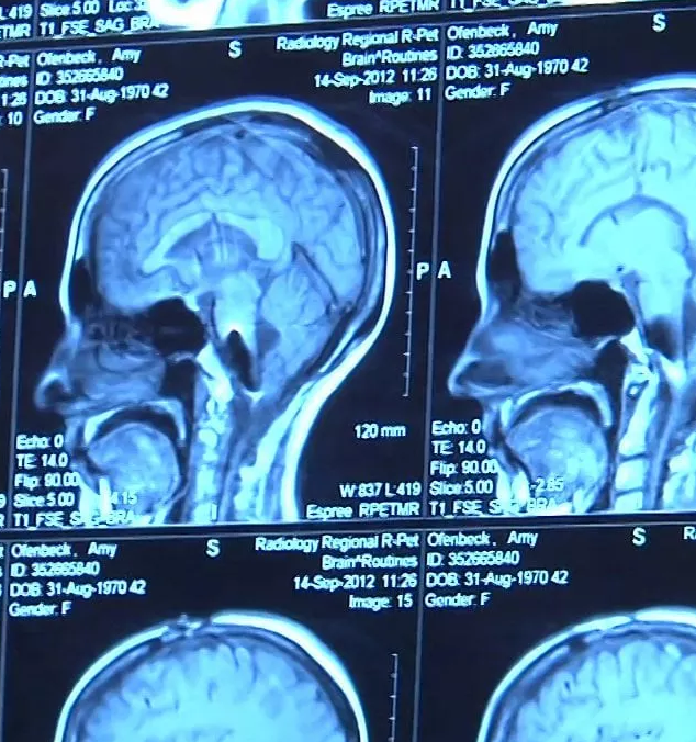 Imagem ilustrativa do curso Neuroimagem
