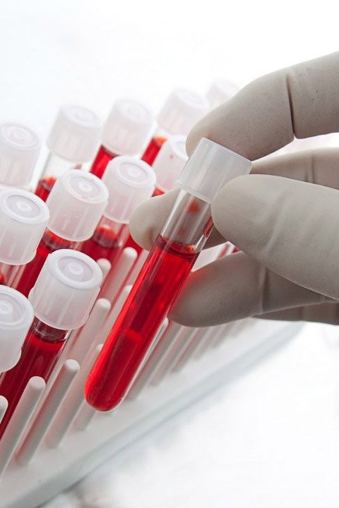 Imagem ilustrativa do curso Banco de Sangue e Hematologia Clínica