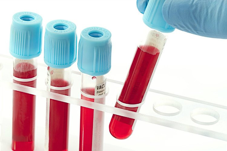Imagem ilustrativa do curso Hematologia e Imuno-hematologia
