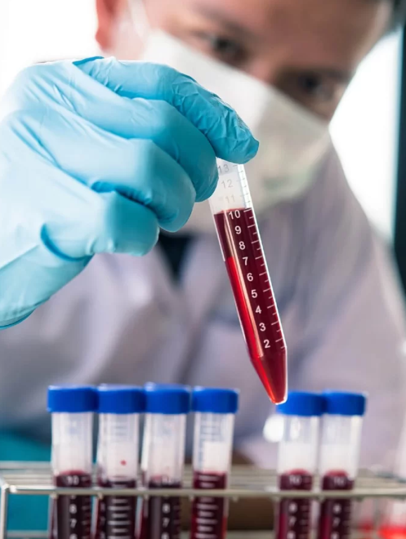 Imagem ilustrativa do curso Hematologia Básica e Clínica