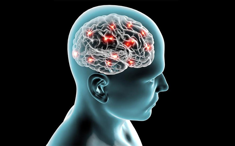 Imagem ilustrativa do curso Neuropsicologia